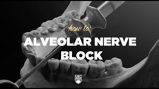 Inferior Alveolar Nerve Block Technique oral surgery 20192020 [upl. by Kung]