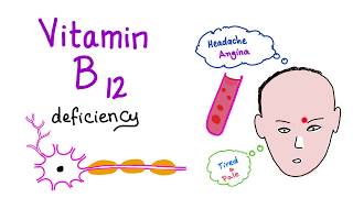 Vitamin B12 Cobalamin Deficiency  Causes Symptoms Diagnosis amp Management  Hematology Series [upl. by Eerhs115]