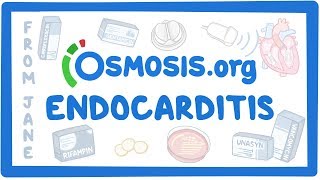 Clinicians Corner Endocarditis [upl. by Elon]