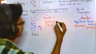 Antibody test qualitative [upl. by Alram]