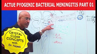 Acute Pyogenic Bacterial Meningitis Part 1 🩺 [upl. by Blight]