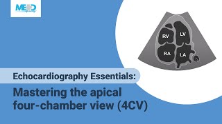 Lecture 2  Transthoracic Echocardiography Part 1 [upl. by Aihsenot]