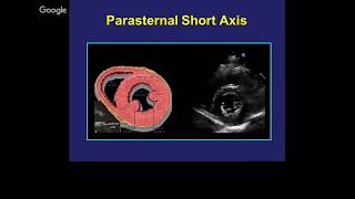 Basics of Transthoracic Echocardiography Dr Viola William [upl. by Annetta]