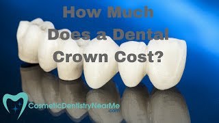 How Much Does a Dental Crown Cost [upl. by Augie]