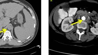 Introduction to Radiology Computed Tomography [upl. by Yelsnia]