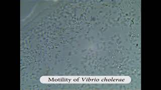 Motility of Vibrio cholerae [upl. by Beryl]