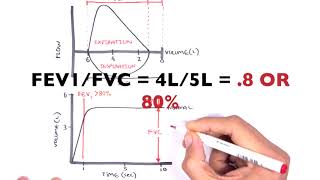 Understanding Spirometry  Normal Obstructive vs Restrictive [upl. by Lekzehcey]