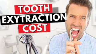 Cost of a Tooth Extraction  Teeth Extractions [upl. by Gross]