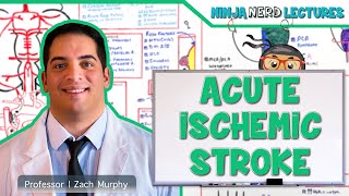 Types of Ischaemic Stroke  Oxford Bamford Classification  Details [upl. by Ozan]