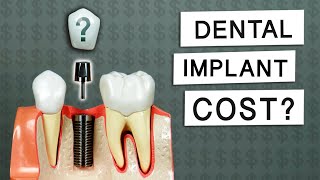 How Much Do Dental Implants Cost [upl. by Ymirej485]