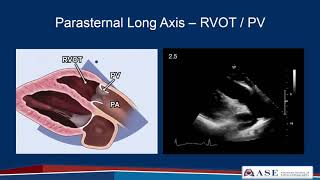 Comprehensive Transesophageal Echocardiograhic TEE Examination [upl. by Cowie968]