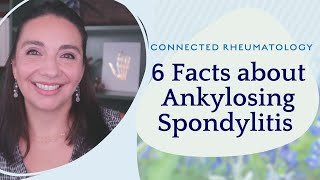 6 Facts about Ankylosing Spondylitis [upl. by Ordnasil336]