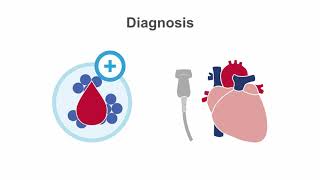 Endocarditis 101 Diagnosis and Treatment [upl. by Korten]