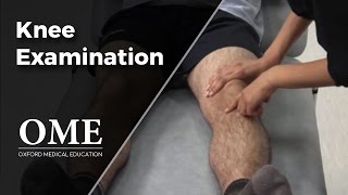 Knee Examination  Orthopaedics [upl. by Hsirehc350]